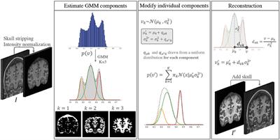 A Contrast Augmentation Approach to Improve Multi-Scanner Generalization in MRI